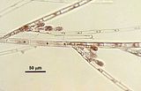 3 - Dettaglio delle monosporocisti